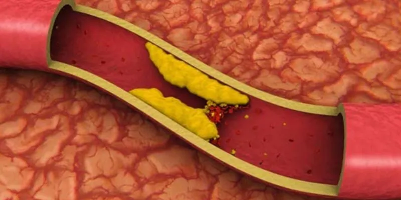 Vina Tảo Spirulina