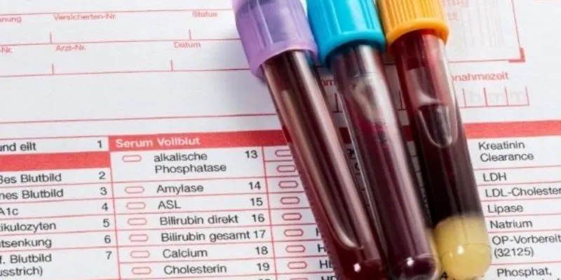 thông báo về việc